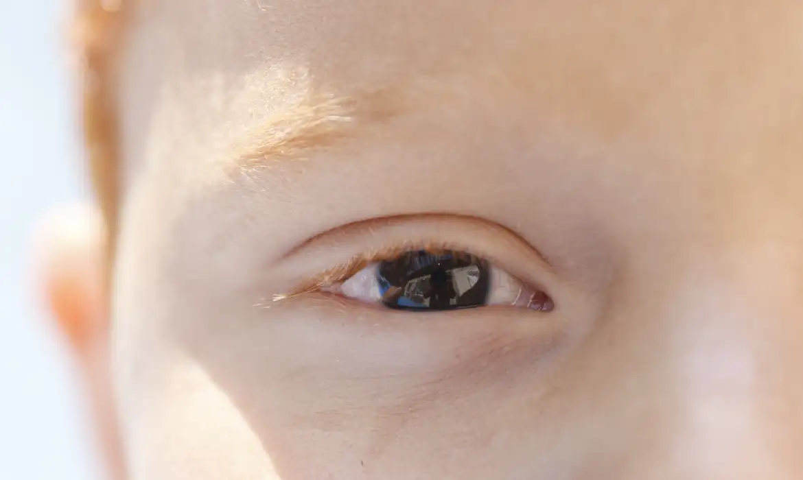 Erros de refração são principal causa de deficiência visual infantil